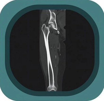 CT thigh anatomy icon-1771230454